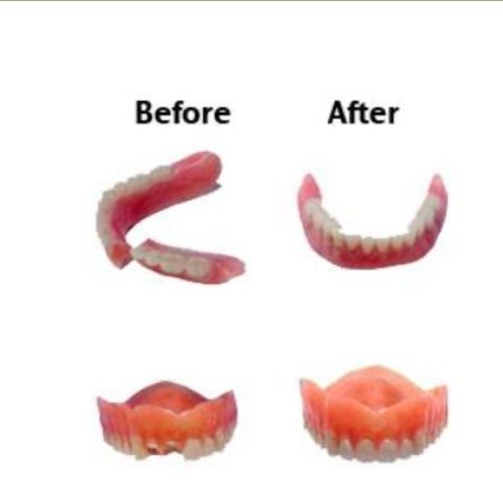 Professional Grade Denture Repair Kit Glue N27695