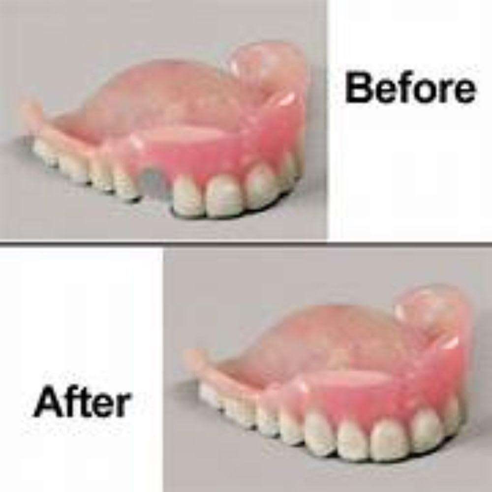 Professional Grade Denture Repair Kit Glue N27695