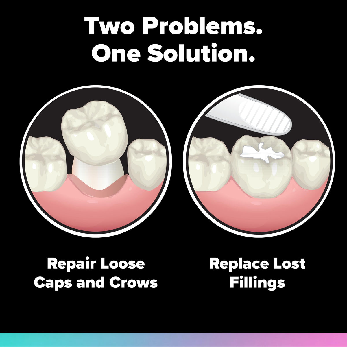 Loose Cap and Lost Filling Repair Dental Kit F175560